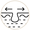 毛穴開き